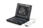notebook ultrasound scanner